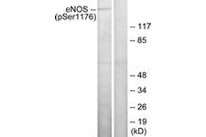 Western blot analysis of extracts from HeLa cells treated with Insulin 0. (ENOS antibody  (pSer1177))