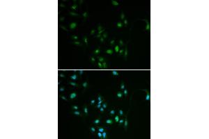 Immunofluorescence analysis of MCF7 cell using BCL2 antibody. (Bcl-2 antibody  (AA 81-131))