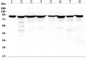 Western blot analysis of RDX using anti-RDX antibody (ABIN7602767).
