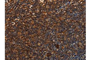 The image is immunohistochemistry of paraffin-embedded Human tonsil tissue using ABIN7131549(UPK3B Antibody) at dilution 1/25. (Uroplakin 3B antibody)