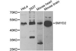 Western blot analysis of extracts of various cell lines, using SMYD2 antibody. (SMYD2A antibody)
