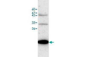 Western blot analysis of BGC-823 whole cell lystae with TNNI3 polyclonal antibody  at 1:500 dilution. (TNNI3 antibody)