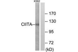Western blot analysis of extracts from K562 cells, using CIITA Antibody. (CIITA antibody  (AA 706-755))
