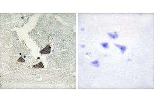 Peptide - + (EPH Receptor B6 antibody)