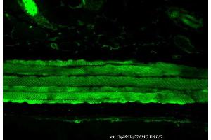 Immunohistochemistry analysis using Mouse Anti-Hsp27 Monoclonal Antibody, Clone 8A7 . (HSP27 antibody  (FITC))