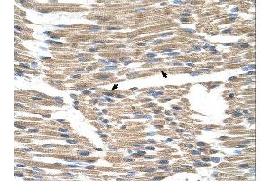 Immunohistochemistry (IHC) image for anti-Wntless Homolog (WLS) (N-Term) antibody (ABIN2781859) (GPR177/WLS antibody  (N-Term))