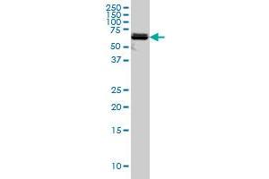 Western Blotting (WB) image for anti-3'-phosphoadenosine 5'-phosphosulfate Synthase 2 (PAPSS2) (AA 513-613) antibody (ABIN598592) (PAPSS2 antibody  (AA 513-613))