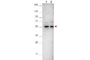 Western Blotting (WB) image for anti-V-Akt Murine Thymoma Viral Oncogene Homolog 1 (AKT1) (C-Term) antibody (ABIN400790) (AKT1 antibody  (C-Term))