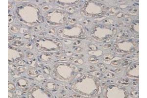 Immunohistochemical staining of formalin-fixed paraffin-embedded human kidney tissue with ADAMTS1 polyclonal antibody  at 1 : 100 dilution. (ADAMTS1 antibody  (C-Term))