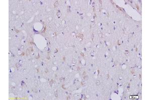 Formalin-fixed and paraffin embedded rat brain tissue labeled with Anti-CLEC1/CLEC1A Polyclonal Antibody, Unconjugated (ABIN741795) at 1:200 followed by conjugation to the secondary antibody and DAB staining (CLEC1A antibody  (AA 151-280))