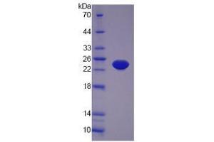 Image no. 1 for Tumor Necrosis Factor alpha (TNF alpha) (AA 57-235) (Active) protein (His tag) (ABIN6239733)
