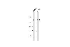 All lanes : Anti-TOP2A Antibody (C-term) at 1:1000 dilution Lane 1: Jurkat whole cell lysate Lane 2: K562 whole cell lysate Lysates/proteins at 20 μg per lane. (Topoisomerase II alpha antibody  (C-Term))