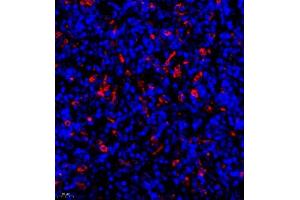 Immunofluorescence (Paraffin-embedded Sections) (IF (p)) image for anti-HLA-DR-gamma (CD74) antibody (ABIN7074245)