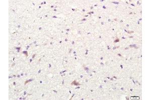 Paraformaldehyde-fixed, paraffin embedded rat brain tissue, Antigen retrieval by boiling in sodium citrate buffer(pH6) for 15min, Block endogenous peroxidase by 3% hydrogen peroxide for 30 minutes, Blocking buffer (normal goat serum) at 37°C for 20min, Antibody incubation with Rabbit Anti-CD80 Polyclonal Antibody, Unconjugated  at 1:400 overnight at 4°C, followed by a conjugated secondary and DAB staining (CD80 antibody  (AA 251-321))