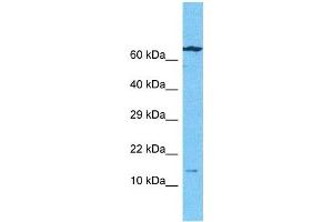 Host:  Rabbit  Target Name:  BMF  Sample Type:  Ovary Tumor lysates  Antibody Dilution:  1ug/ml (BMF antibody  (N-Term))