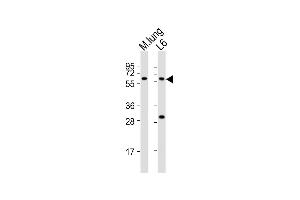 All lanes : Anti-Yes1 Antibody (Center) at 1:2000 dilution Lane 1: mouse lung lysates Lane 2: L6 whole cell lysates Lysates/proteins at 20 μg per lane. (YES1 antibody  (AA 148-182))