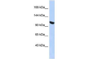WB Suggested Anti-UBA1 Antibody Titration: 0. (UBA1 antibody  (N-Term))