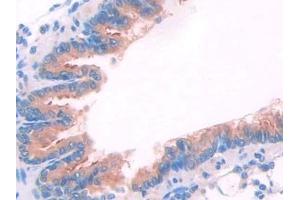 Immunohistochemistry (IHC) image for anti-Janus Kinase 2 (JAK2) (AA 916-1103) antibody (ABIN7438352)