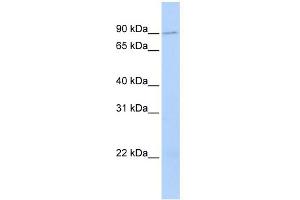 WB Suggested Anti-TMCC2 Antibody Titration:  0. (TMCC2 antibody  (N-Term))