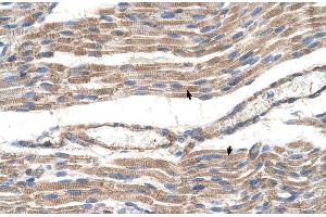 Human Muscle (SLC2A6 antibody  (C-Term))