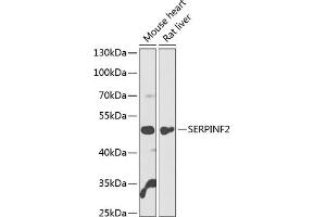 Western blot analysis of extracts of various cell lines, using SERPINF2 antibody  at 1:1000 dilution. (alpha 2 Antiplasmin antibody  (AA 302-491))