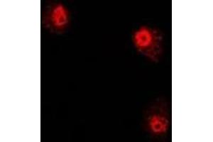 Immunofluorescent analysis of PHYH staining in U2OS cells. (PHYH antibody)