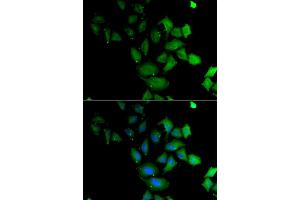 Immunofluorescence analysis of U2OS cell using PSG1 antibody. (PSG1 antibody)