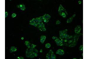 Immunofluorescent staining of HeLa cells using anti-RNF144B mouse monoclonal antibody (ABIN2453611). (RNF144B antibody  (AA 1-256))