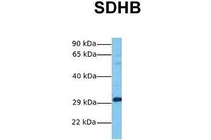 Host:  Rabbit  Target Name:  SDHB  Sample Tissue:  Human Fetal Lung  Antibody Dilution:  1. (SDHB antibody  (Middle Region))