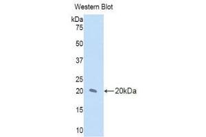 Western Blotting (WB) image for anti-Interleukin 17 Receptor D (IL17RD) (AA 157-299) antibody (ABIN1859365) (IL17RD antibody  (AA 157-299))