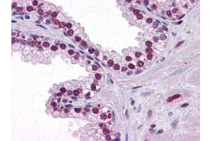 Immunohistochemistry (IHC) image for anti-Androgen Receptor (AR) antibody (ABIN1724724)