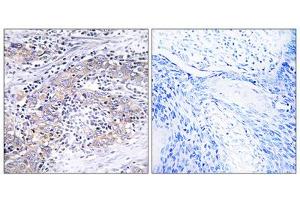 Immunohistochemistry analysis of paraffin-embedded human cervix tissue using CLN6 antibody. (CLN6 antibody  (C-Term))