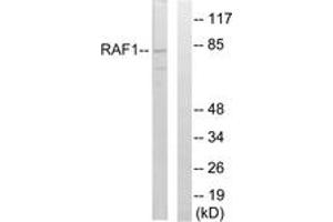 Western Blotting (WB) image for anti-V-Raf-1 Murine Leukemia Viral Oncogene Homolog 1 (RAF1) (AA 251-300) antibody (ABIN2889118) (RAF1 antibody  (AA 251-300))