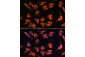 Immunofluorescence analysis of U-2 OS cells using OBSCN antibody (ABIN7269076) at dilution of 1:100. (Obscurin antibody)