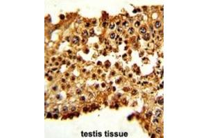 Immunohistochemistry (IHC) image for anti-Pituitary Tumor-Transforming 1 (PTTG1) antibody (ABIN3003161)
