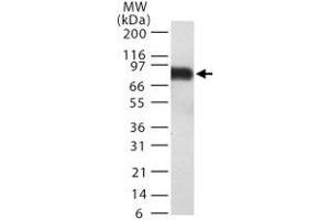 Western blot detection of TEM8 in TEM8 transfected 293 cell lysate. (ANTXR1 antibody  (AA 481-497))