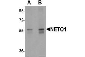 Western blot analysis of NETO1 in human lung tissue lysate with NETO1 Antibody  at (A) 1 and (B) 2 μg/mL. (NETO1 antibody  (C-Term))