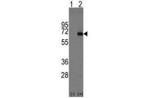 Image no. 1 for anti-alpha-Fetoprotein (AFP) (Center) antibody (ABIN356915) (alpha Fetoprotein antibody  (Center))