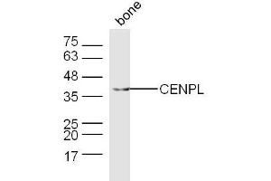 Mouse bone lysates probed with CENPL Polyclonal Antibody, Unconjugated  at 1:300 dilution and 4˚C overnight incubation. (CENPL antibody  (AA 51-150))