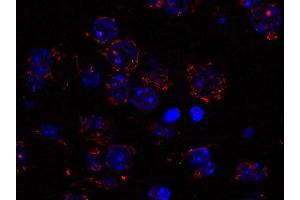Immunohistochemistry (Paraffin-embedded Sections) (IHC (p)) image for anti-Golgin B1 (GOLGB1) (AA 1-427) antibody (ABIN1742522)
