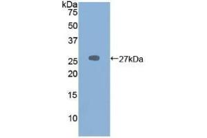 Detection of Recombinant PRSS2, Mouse using Polyclonal Antibody to Protease, Serine 2 (PRSS2) (PRSS2 antibody  (AA 29-240))