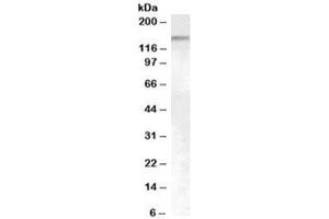 Western blot testing of HeLa cell nuclear lysate with SENP6 antibody at 0. (SENP6 antibody)