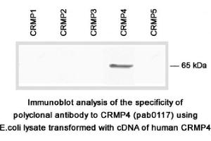 Image no. 1 for anti-Dihydropyrimidinase-Like 3 (DPYSL3) (C-Term) antibody (ABIN347041)