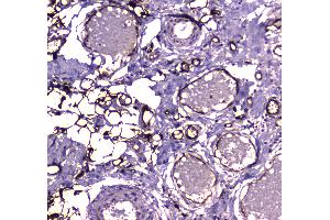 IHC analysis of FABP5 using anti-FABP5 antibody . (FABP5 antibody)