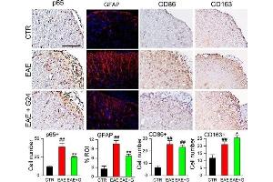 Chronic phase glibenclamide reduces inflammation and improves the macrophage phenotype in EAE. (CD86 antibody  (AA 140-175))