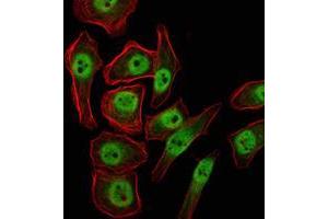 Immunofluorescence analysis of NTERA-2 cells using KDM4A mouse mAb (green). (KDM4A antibody)