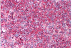 Human Spleen (formalin-fixed, paraffin-embedded) stained with CD82 antibody ABIN213919 at 0. (CD82 antibody  (C-Term))