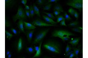 Image provided by One World Lab validation program. (ATM antibody  (AA 2681-2750))