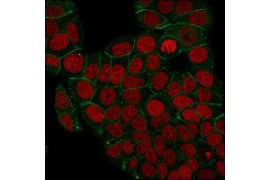 Immunofluorescence staining of PFA-fixed MCF-7 cells with Catenin, gamma Mouse Monoclonal Antibody (rCTNG/1664) followed by goat anti-Mouse IgG-CF488 (Green). (Recombinant JUP antibody)