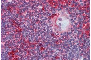 Human Thymus (formalin-fixed, paraffin-embedded) stained with LCK antibody ABIN296046 at 5 ug/ml followed by biotinylated anti-mouse IgG secondary antibody ABIN481714, alkaline phosphatase-streptavidin and chromogen. (LCK antibody)
